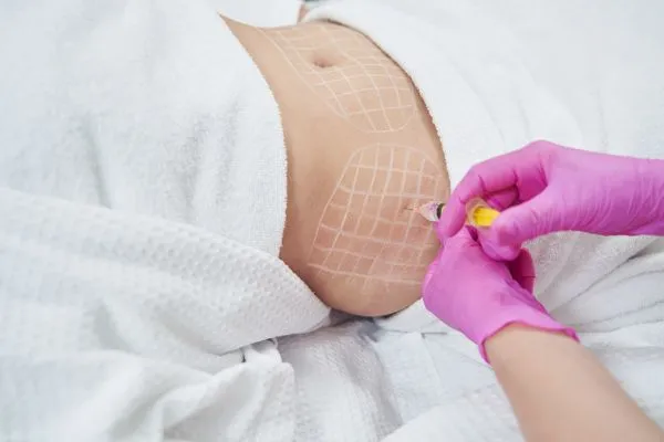 image of fat dissolving injections on love handles to help combat weight gain Prestwich