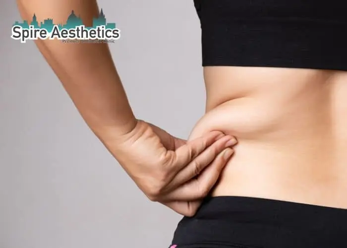 Image of woman pinching fat on their hips Prestwich. Fat Freezing treatment