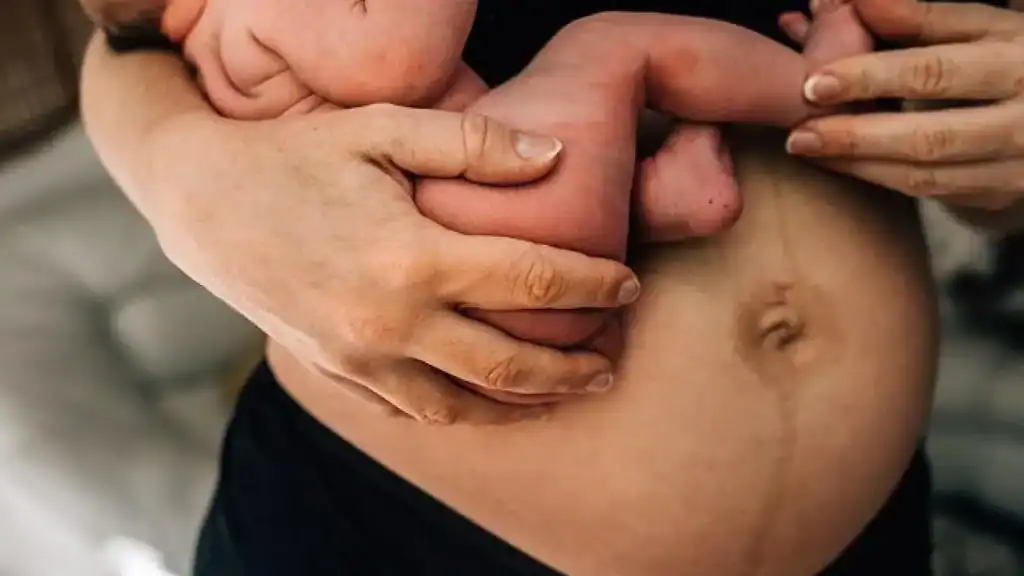 Why Is My Stomach Still Big After Pregnancy Prestwich?